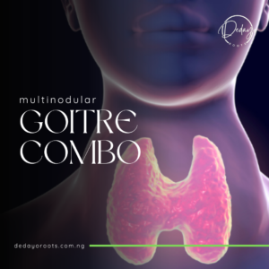 multinodular goiter